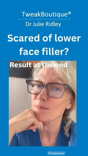 Dr Julie Ridley answering a common worry about lower face filler